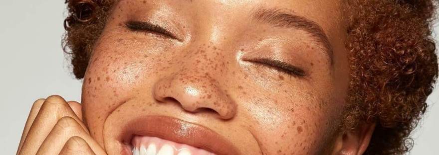 black woman freckles